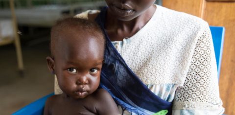 Criança, no colo da mãe, examinada por desnutrição em hospital do Sudão do Sul: fome atinge 800 milhões de pessoas (Foto: Unicef/Divulgação)