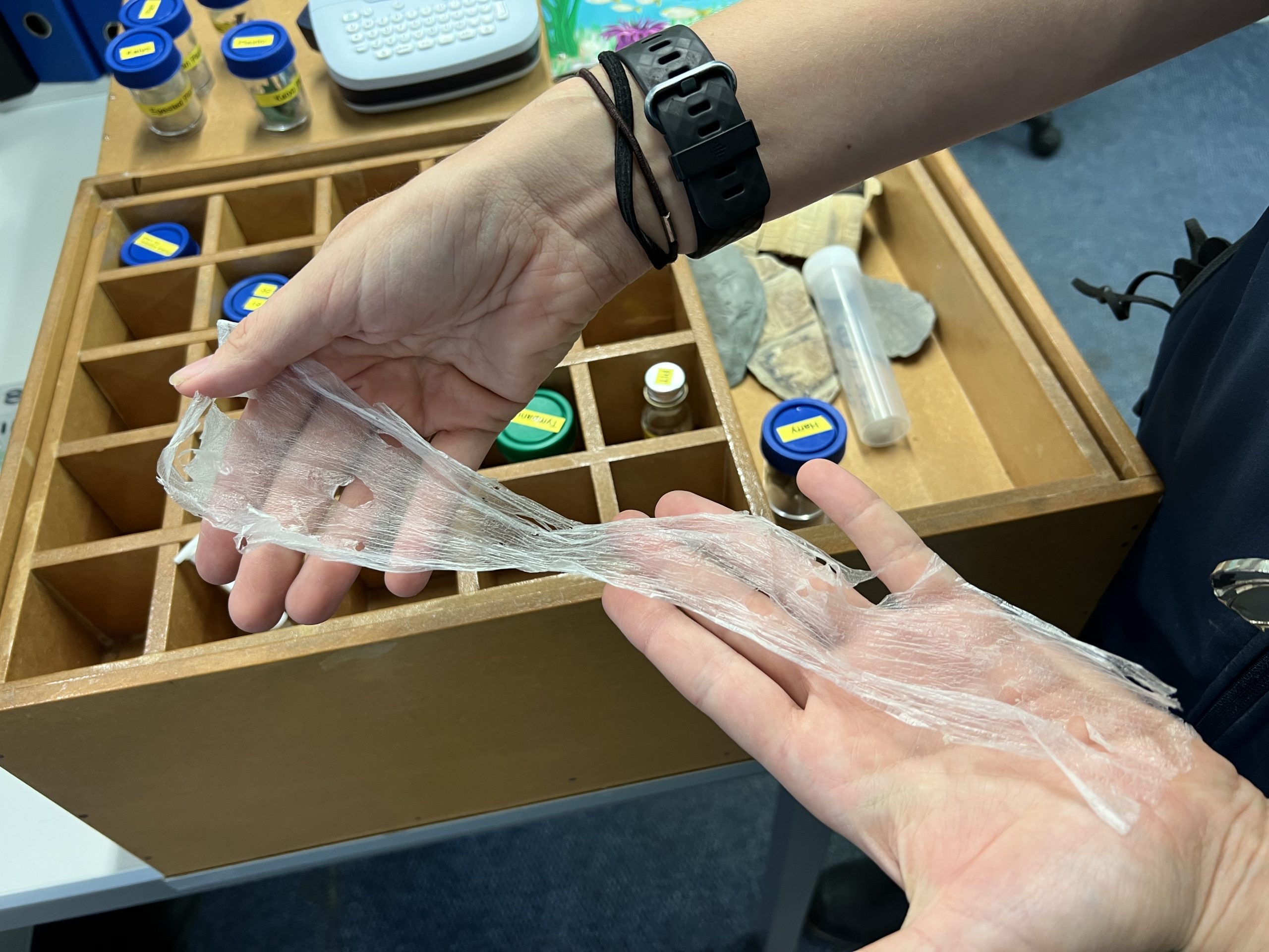 Um enorme plástico transparente encontrado no corpo de uma tartaruga. Crescimento no volume de plásticos assusta pesquisadores. Foto Vinícius de Assis